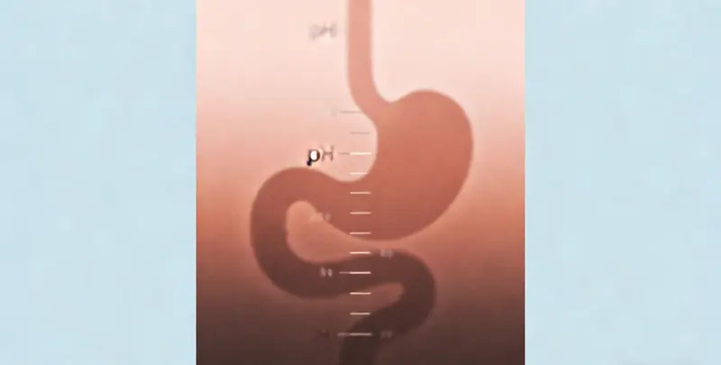 食管癌甲基化检测图3